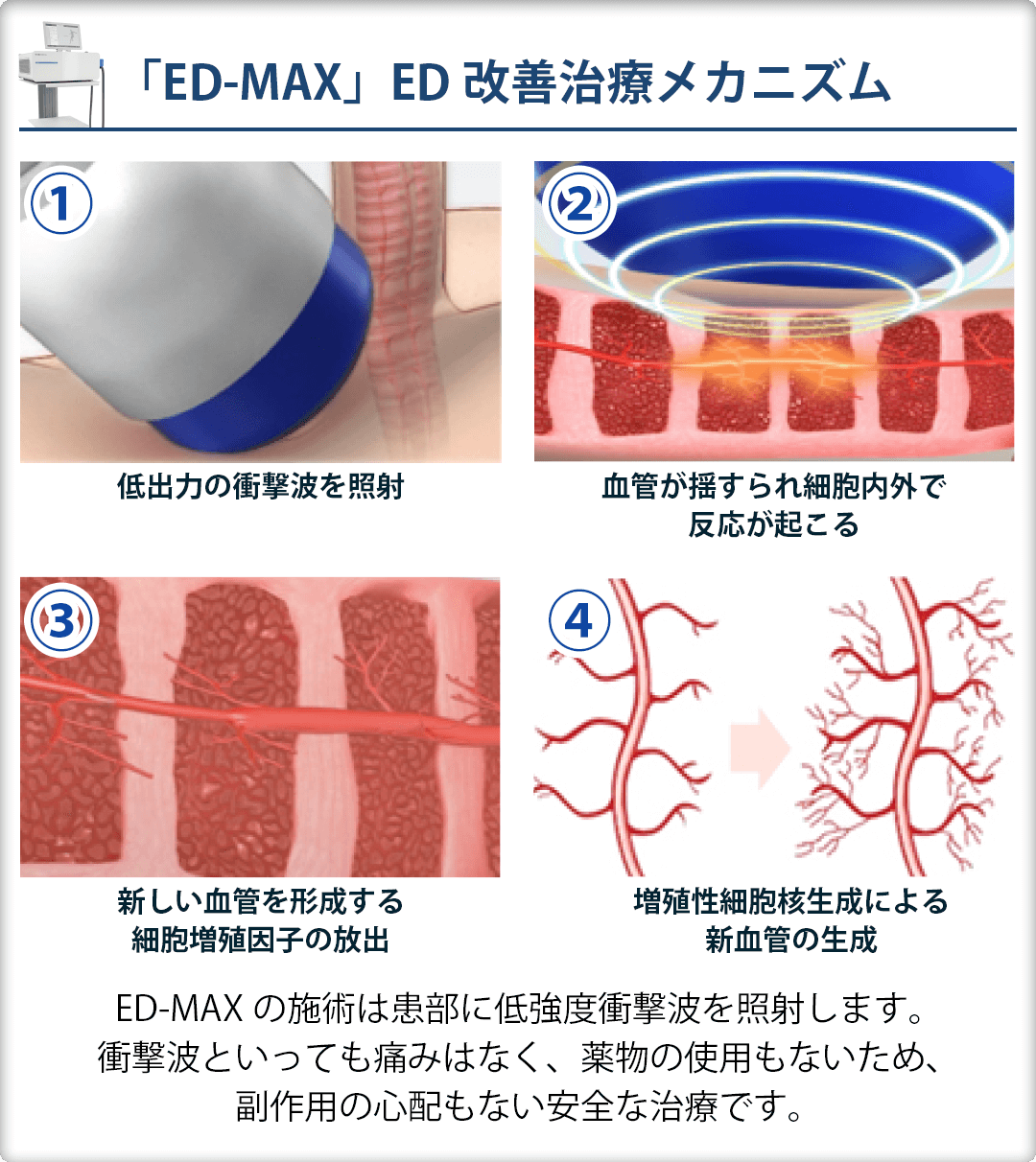 ED-MAX治療のメカニズム